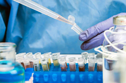 Someone in a lab coat putting liquid in a test tube, which is surrounded by other test tubes.