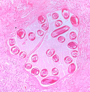 2C Figure C