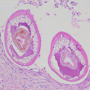 Dioctophyme_LTU_A.jpg