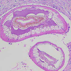 Dioctophyme_LTU_B.jpg
