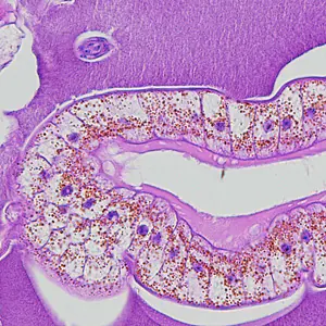 Dioctophyme_LTU_C.jpg