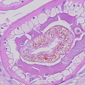 Dioctophyme_LTU_D.jpg Figure D