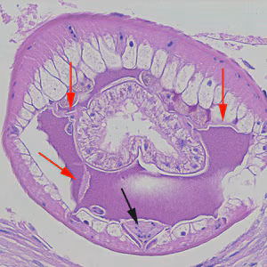Dioctophyme_LTU_E.jpg