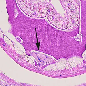 Dioctophyme_LTU_F.jpg
