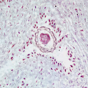 D_renale_egg_tissue1.jpg