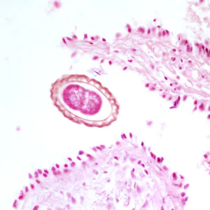 D_renale_egg_tissue3.jpg
