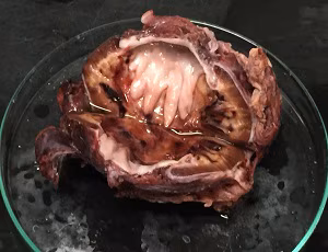 D_re_kidney Figure C