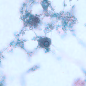 E_gingivalis_troph_BAM2.jpg Figure B