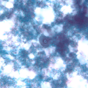 E_gingivalis_troph_BAM3.jpg Figure A