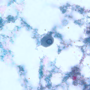 E_gingivalis_troph_BAM4.jpg Figure D