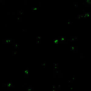 Positive IFA result with B. microti antigen.