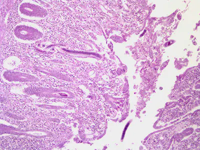 Case201_A.jpg