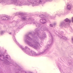 Case201_C.jpg