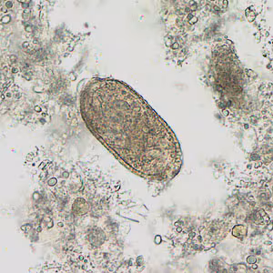 Case201_D.jpg