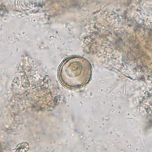 Case309_A.jpg