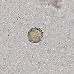 Case309_B.jpg