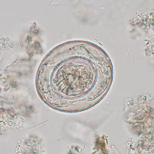 Case342_A.jpg