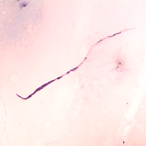 Case370_A.jpg