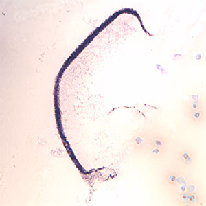 Case370_B.jpg