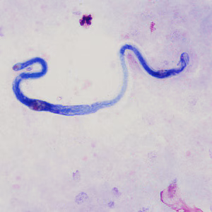 Case370_D.jpg