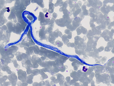 Case370_E.jpg