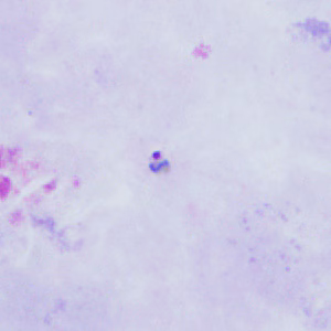 Case398_A.jpg