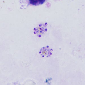 Case398_B.jpg