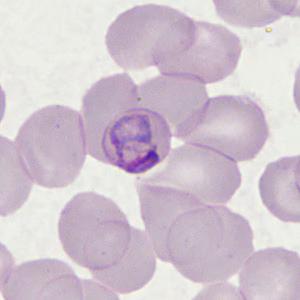 Case398_E.jpg