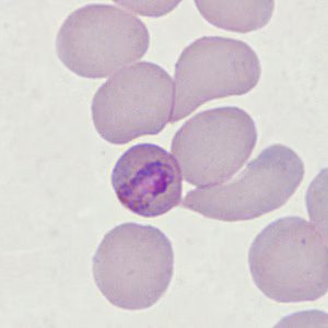 Case398_G.jpg