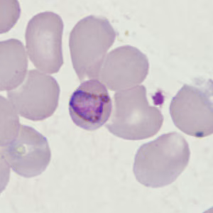 Case398_H.jpg
