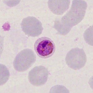 Case398_I.jpg