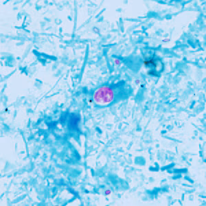 Case409_A.jpg