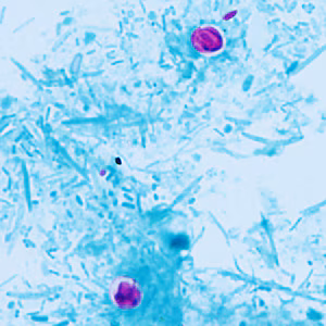 Case409_B.jpg