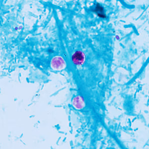 Case409_C.jpg