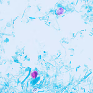 Case409_D.jpg