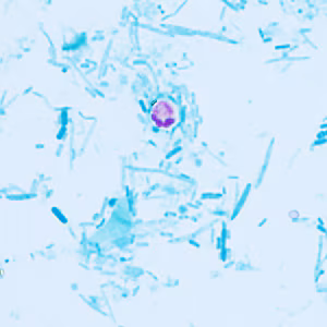 Case409_E.jpg