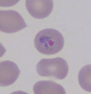Case461_B Parasitic image