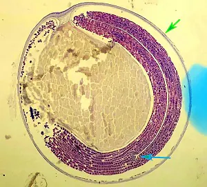 parasitic image