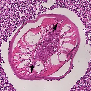 parasitic image