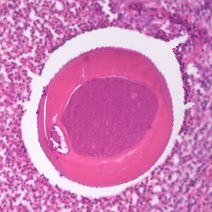 Case479_C parasitic image