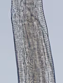 FigureF thelaziasis image