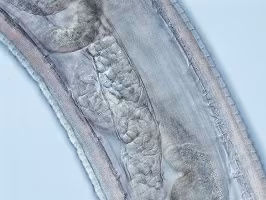 FigureG thelaziasis image