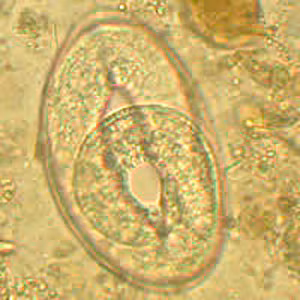 Trichostrongylus_Netherlands_C.jpg