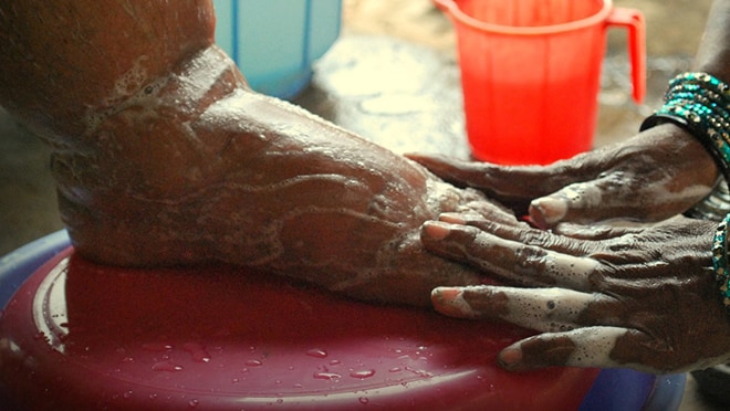 Swollen foot being washed by another person.