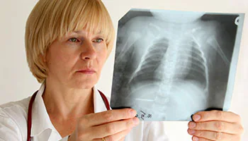 Healthcare provider observing an x-ray of the chest.