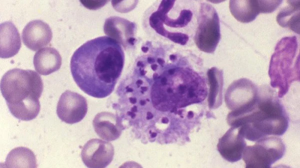 Leishmania donovani