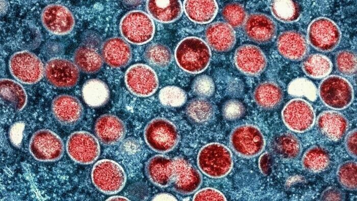 A colorized transmission electron microscopic image of mpox virus particles, found within an infected cell