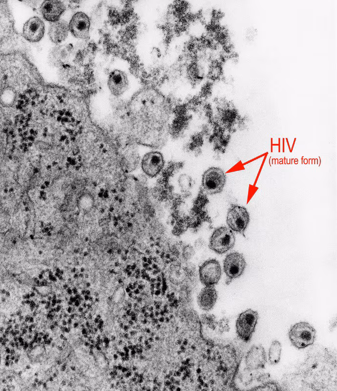 hiv-micrograph hiv-micrograph