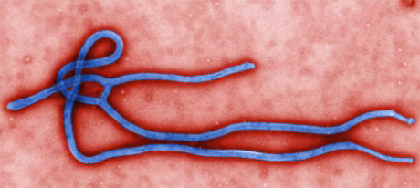 outofcollection01 Ebola microscopic image