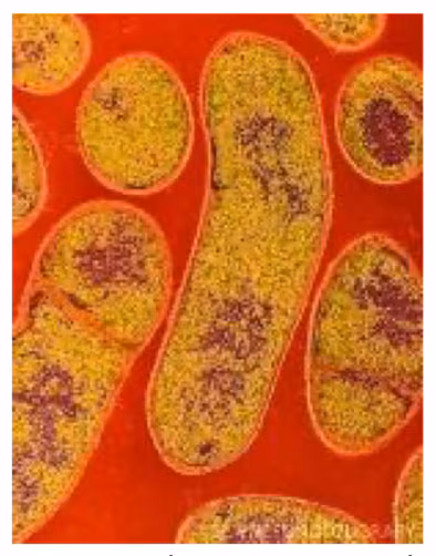 phapproach01 Colored transmission electron micrograph of the Gram-positive anaerobic bacteria Clostridium botulinum.